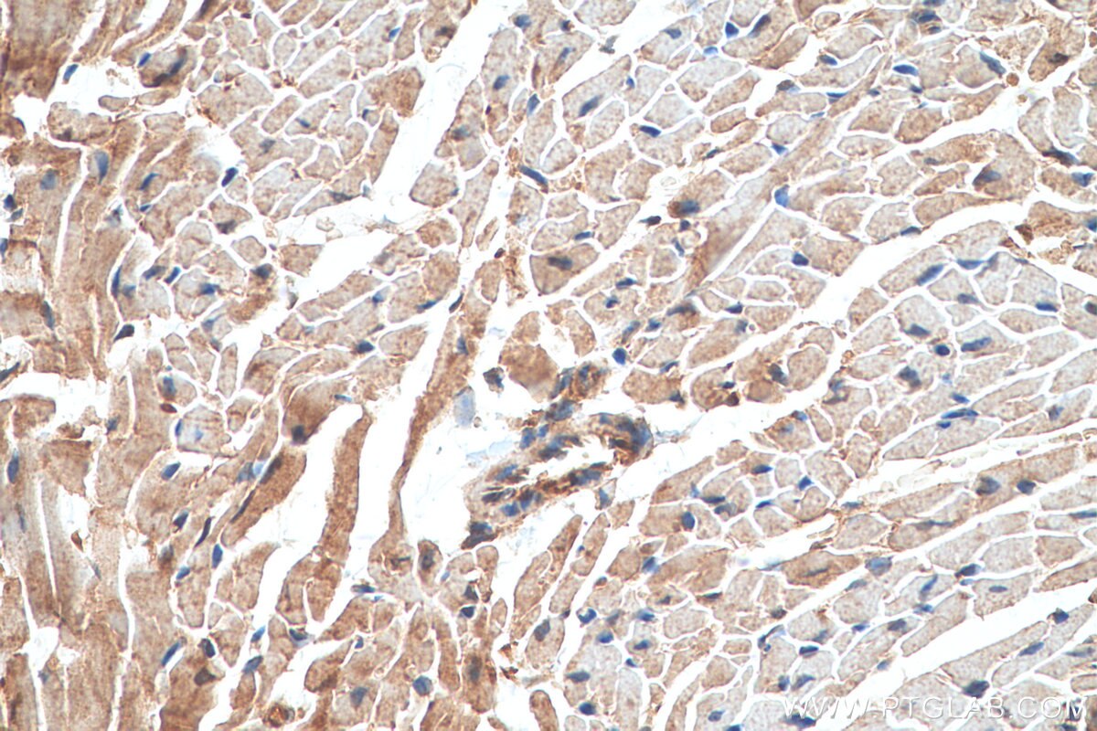 Immunohistochemistry (IHC) staining of mouse heart tissue using Angiopoietin 1 Polyclonal antibody (23302-1-AP)