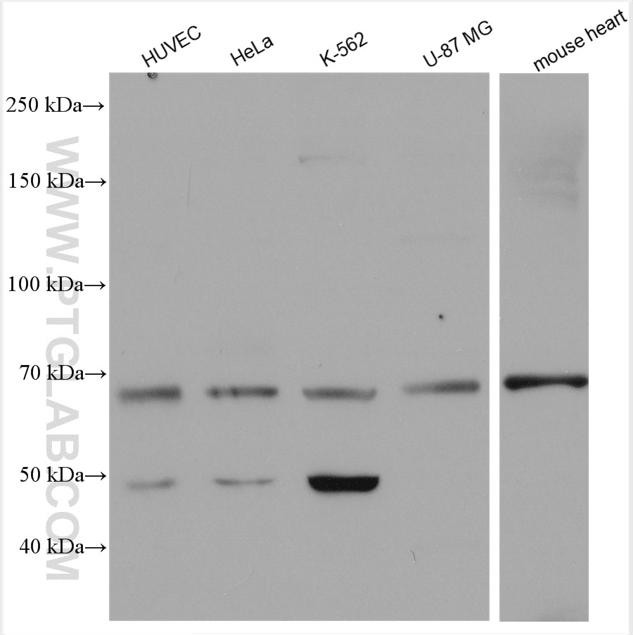 Western Blot (WB) analysis of various lysates using Angiopoietin 1 Polyclonal antibody (23302-1-AP)