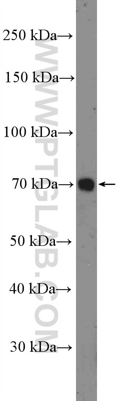 Western Blot (WB) analysis of A375 cells using Angiopoietin 1 Polyclonal antibody (23302-1-AP)