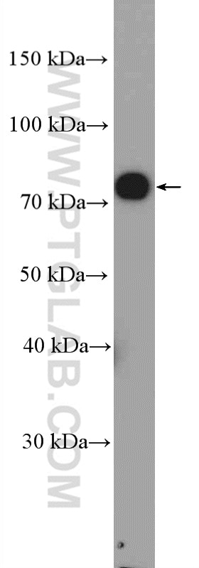 Western Blot (WB) analysis of rat heart tissue using Angiopoietin 1 Polyclonal antibody (23302-1-AP)
