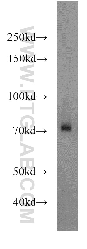 Western Blot (WB) analysis of mouse liver tissue using Angiopoietin 1 Polyclonal antibody (23302-1-AP)