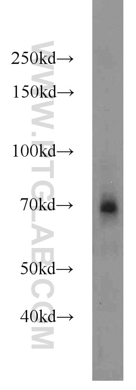 Western Blot (WB) analysis of HepG2 cells using Angiopoietin 1 Polyclonal antibody (23302-1-AP)