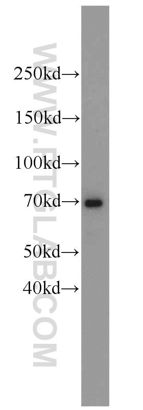 Western Blot (WB) analysis of mouse heart tissue using Angiopoietin 1 Polyclonal antibody (23302-1-AP)