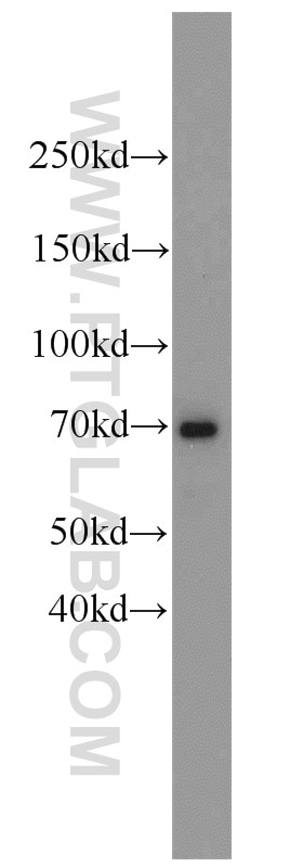 WB analysis of mouse heart using 23302-1-AP