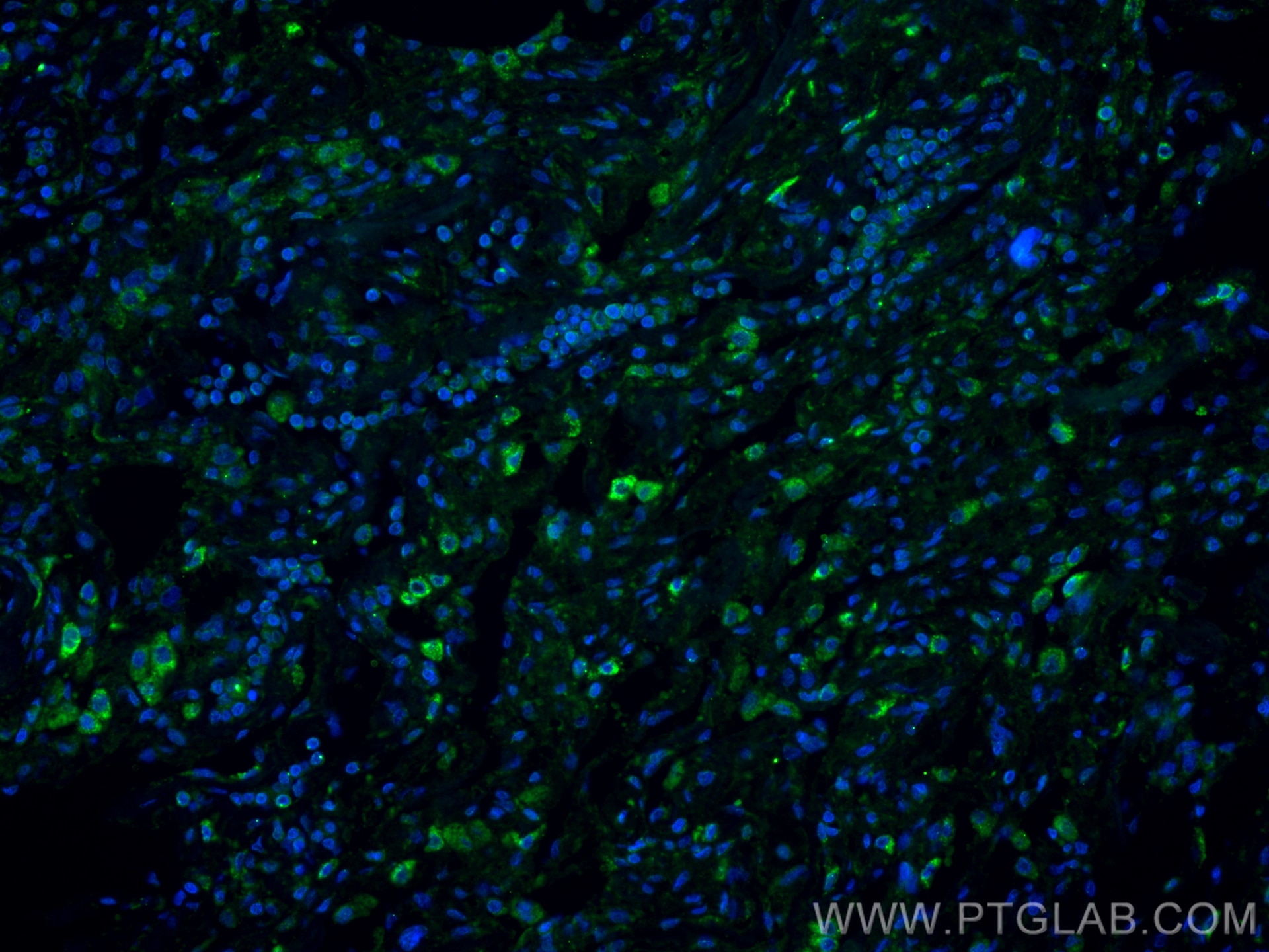 Immunofluorescence (IF) / fluorescent staining of human lung tissue using Angiopoietin 1 Recombinant monoclonal antibody (81990-4-RR)