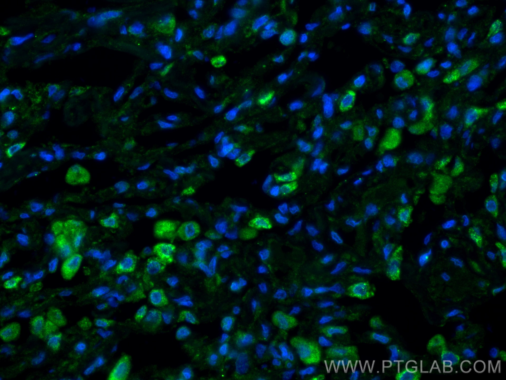 Immunofluorescence (IF) / fluorescent staining of human lung tissue using Angiopoietin 1 Recombinant monoclonal antibody (81990-4-RR)