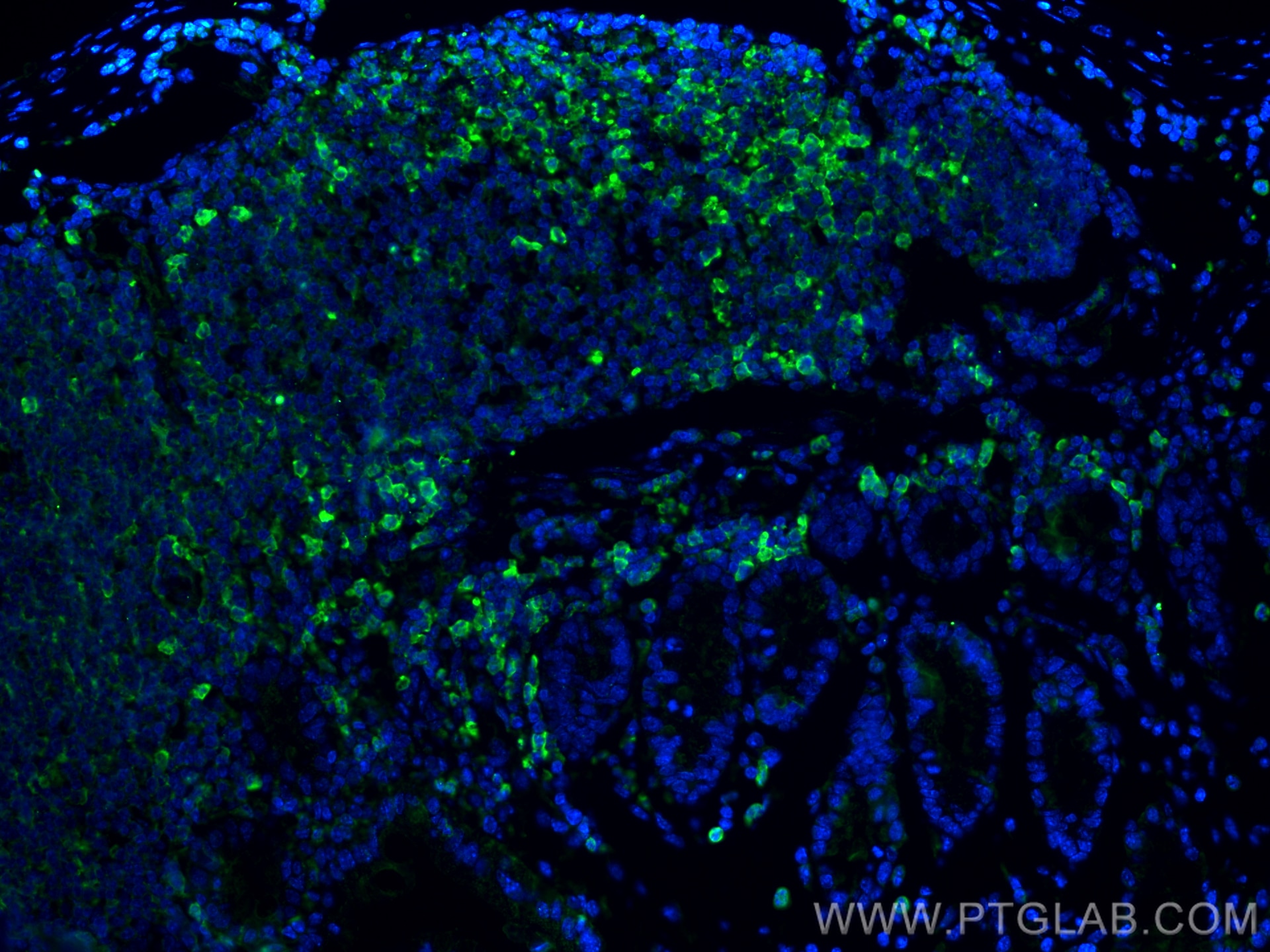 Immunofluorescence (IF) / fluorescent staining of mouse colon tissue using Angiopoietin 1 Recombinant monoclonal antibody (81990-4-RR)