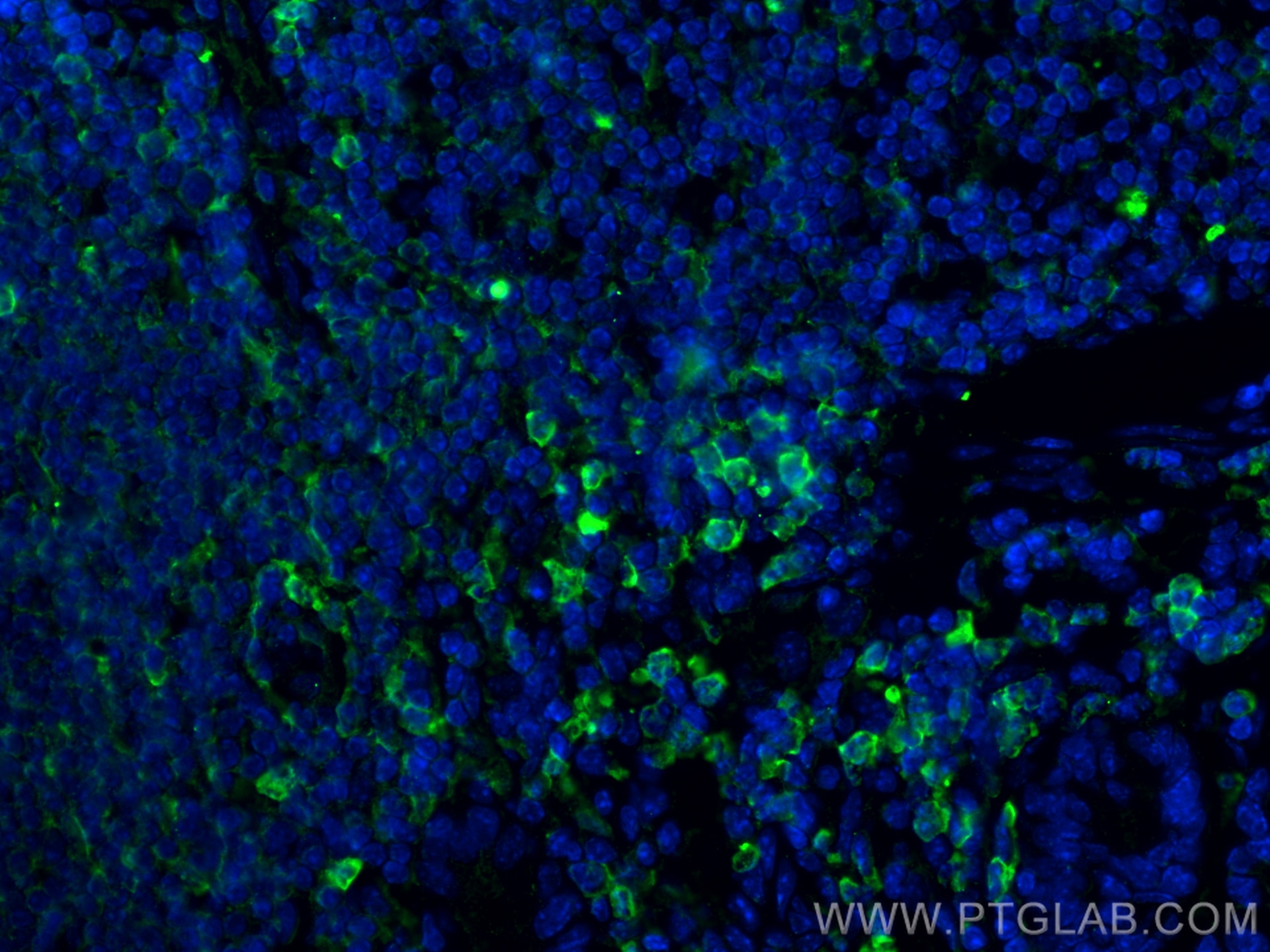 Immunofluorescence (IF) / fluorescent staining of mouse colon tissue using Angiopoietin 1 Recombinant monoclonal antibody (81990-4-RR)