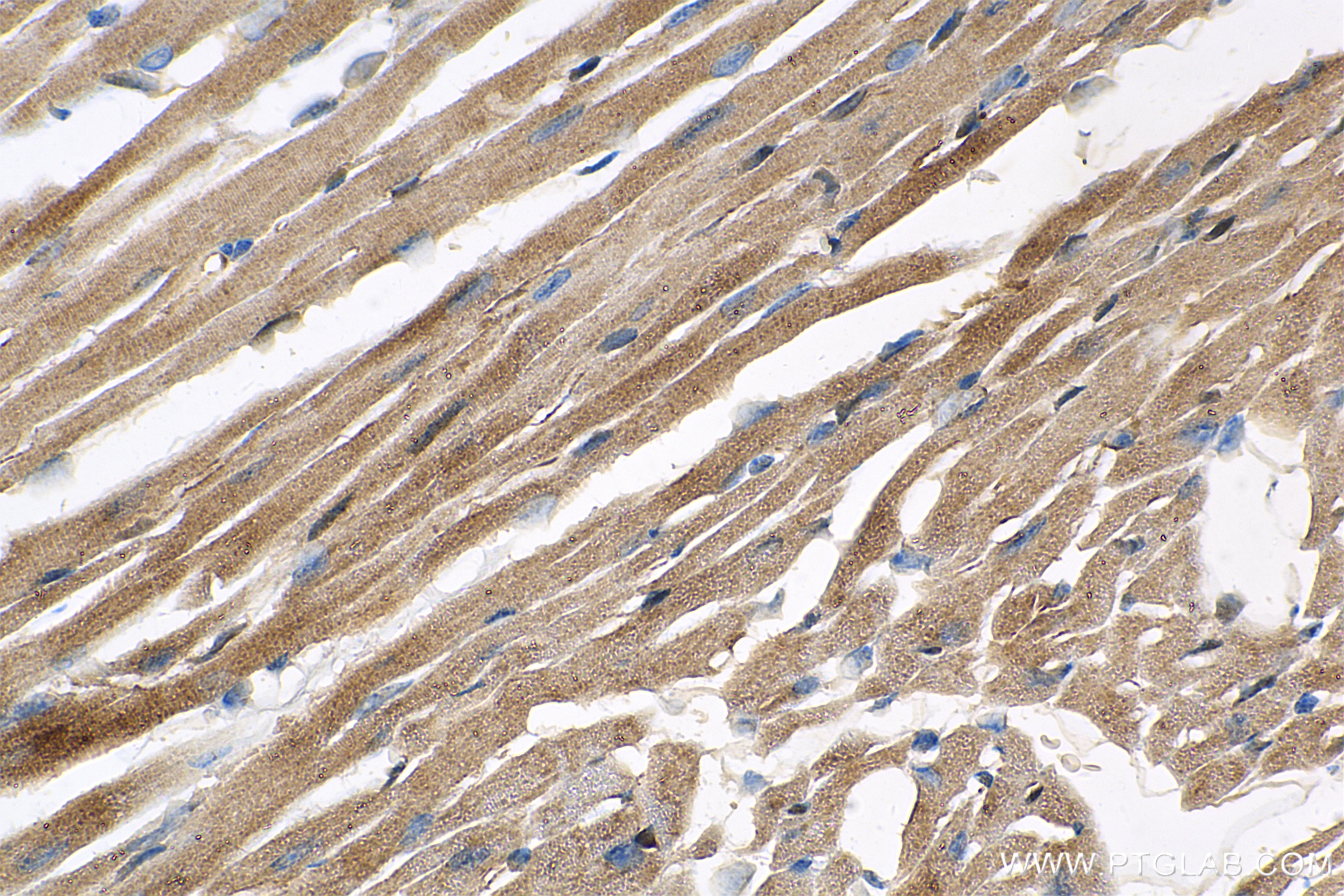 Immunohistochemistry (IHC) staining of mouse heart tissue using Angiopoietin 1 Recombinant antibody (81990-4-RR)