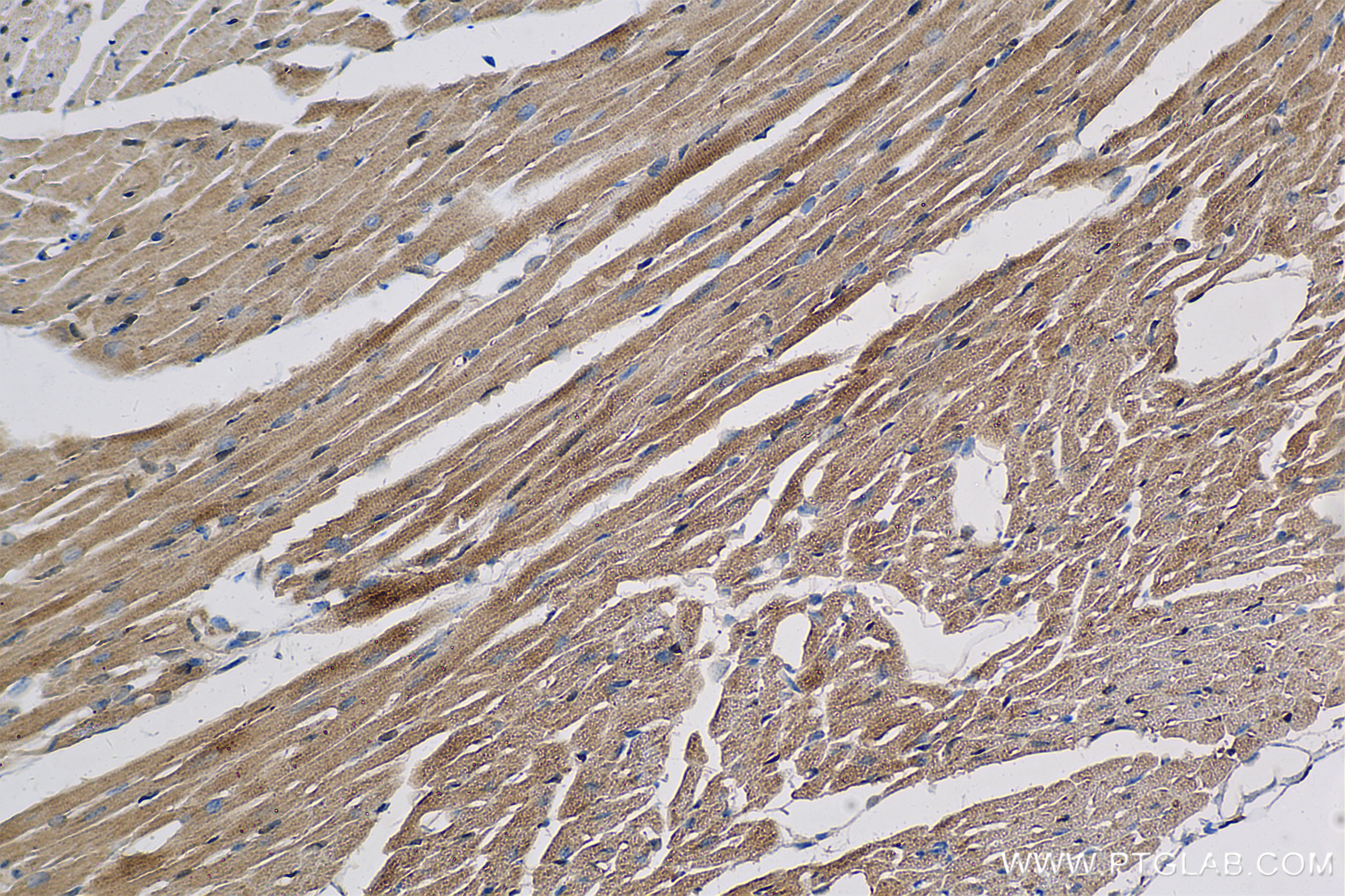 Immunohistochemistry (IHC) staining of mouse heart tissue using Angiopoietin 1 Recombinant monoclonal antibody (81990-4-RR)