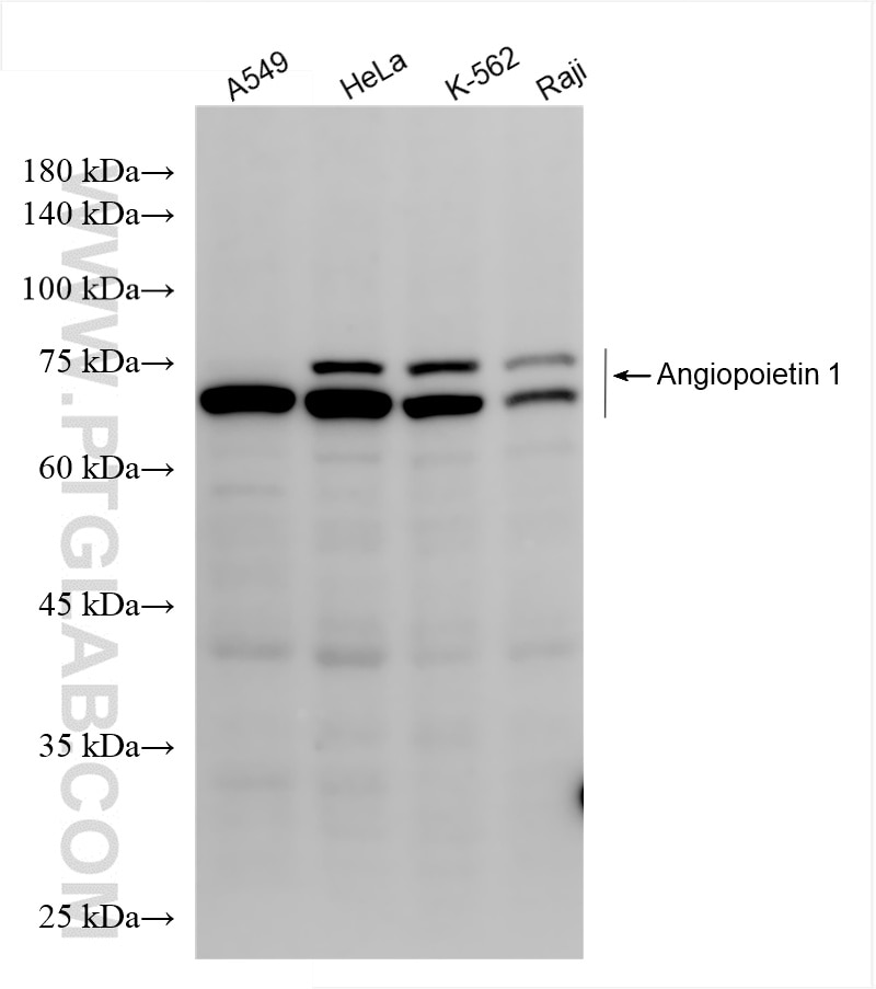 Western Blot (WB) analysis of various lysates using Angiopoietin 1 Recombinant antibody (81990-4-RR)