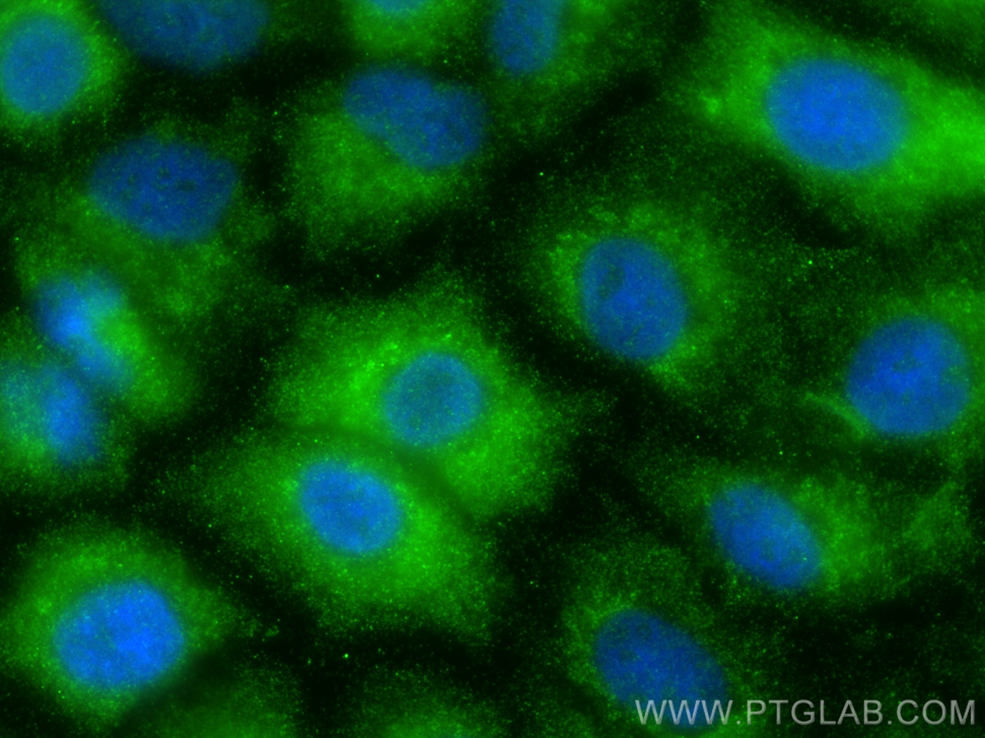 Immunofluorescence (IF) / fluorescent staining of A549 cells using Angiopoietin 2 Polyclonal antibody (24613-1-AP)