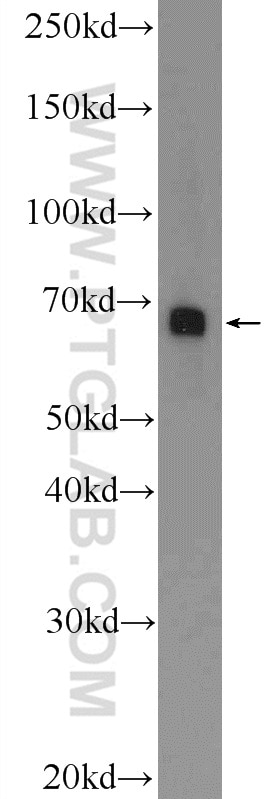 Angiopoietin 2 Polyclonal antibody