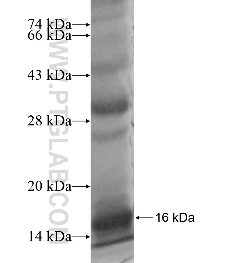 ANGPT2 fusion protein Ag18179 SDS-PAGE