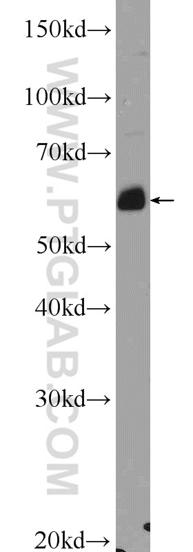 Western Blot (WB) analysis of HeLa cells using ANGPTL1 Polyclonal antibody (14709-1-AP)