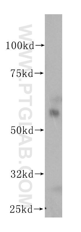 Western Blot (WB) analysis of human heart tissue using ANGPTL1 Polyclonal antibody (14709-1-AP)