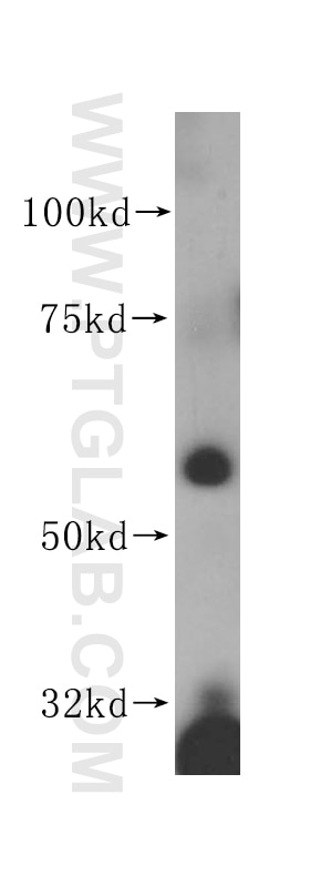 Western Blot (WB) analysis of BxPC-3 cells using ANGPTL1 Polyclonal antibody (14709-1-AP)