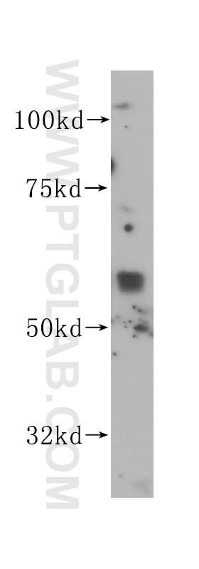 Western Blot (WB) analysis of HEK-293 cells using ANGPTL1 Polyclonal antibody (14709-1-AP)
