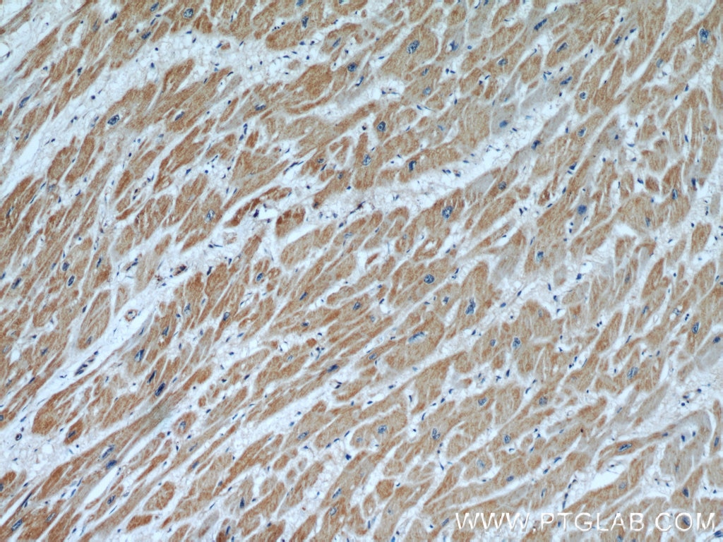 Immunohistochemistry (IHC) staining of human heart tissue using ANGPTL2 Polyclonal antibody (12316-1-AP)