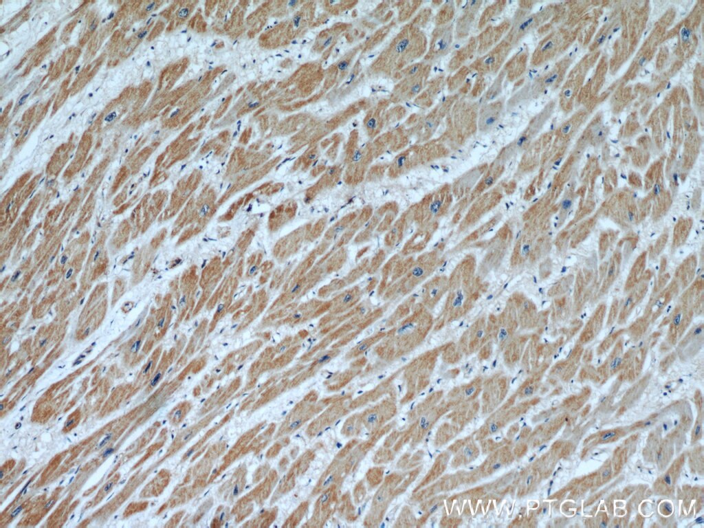 Immunohistochemistry (IHC) staining of human heart tissue using ANGPTL2 Polyclonal antibody (12316-1-AP)
