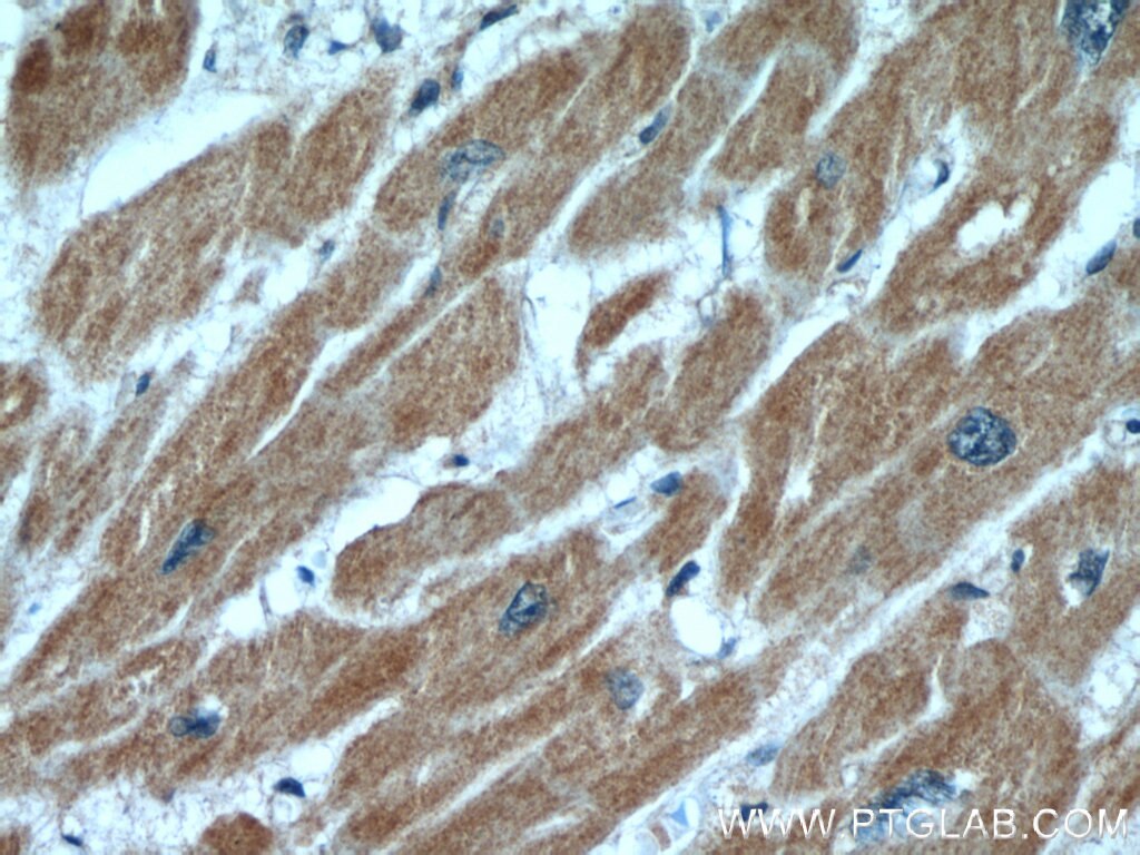 Immunohistochemistry (IHC) staining of human heart tissue using ANGPTL2 Polyclonal antibody (12316-1-AP)