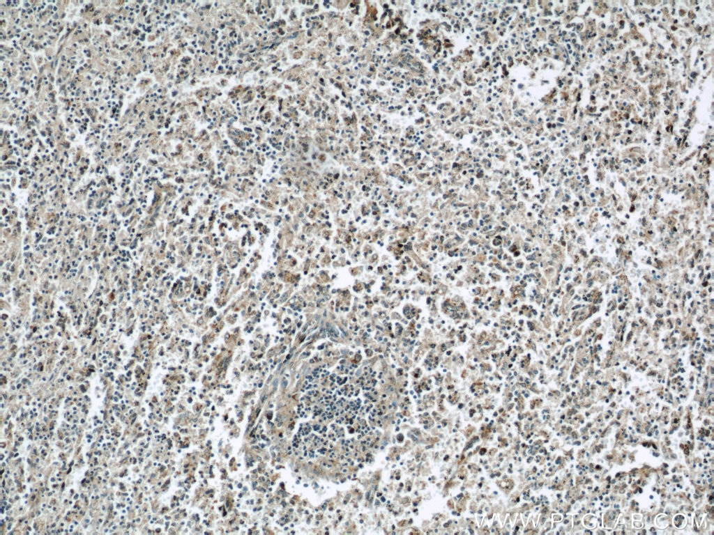 IHC staining of human spleen using 12316-1-AP