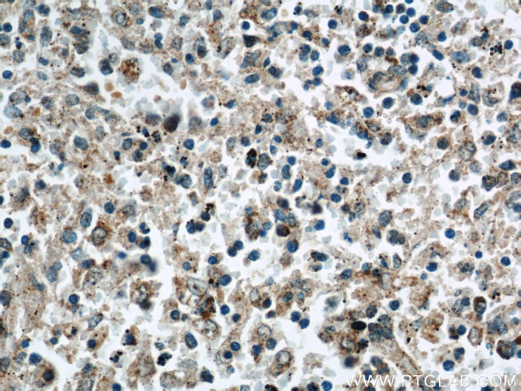 Immunohistochemistry (IHC) staining of human spleen tissue using ANGPTL2 Polyclonal antibody (12316-1-AP)