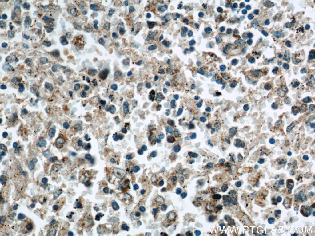 IHC staining of human spleen using 12316-1-AP