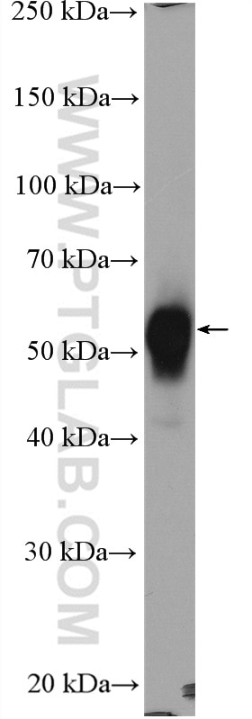 Western Blot (WB) analysis of mouse spleen tissue using ANGPTL2 Polyclonal antibody (12316-1-AP)