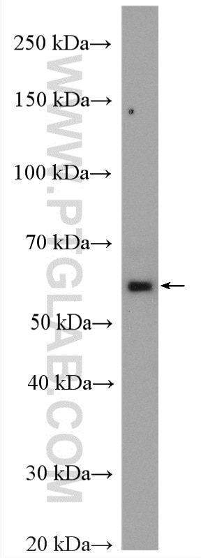 Western Blot (WB) analysis of mouse heart tissue using ANGPTL2 Polyclonal antibody (12316-1-AP)
