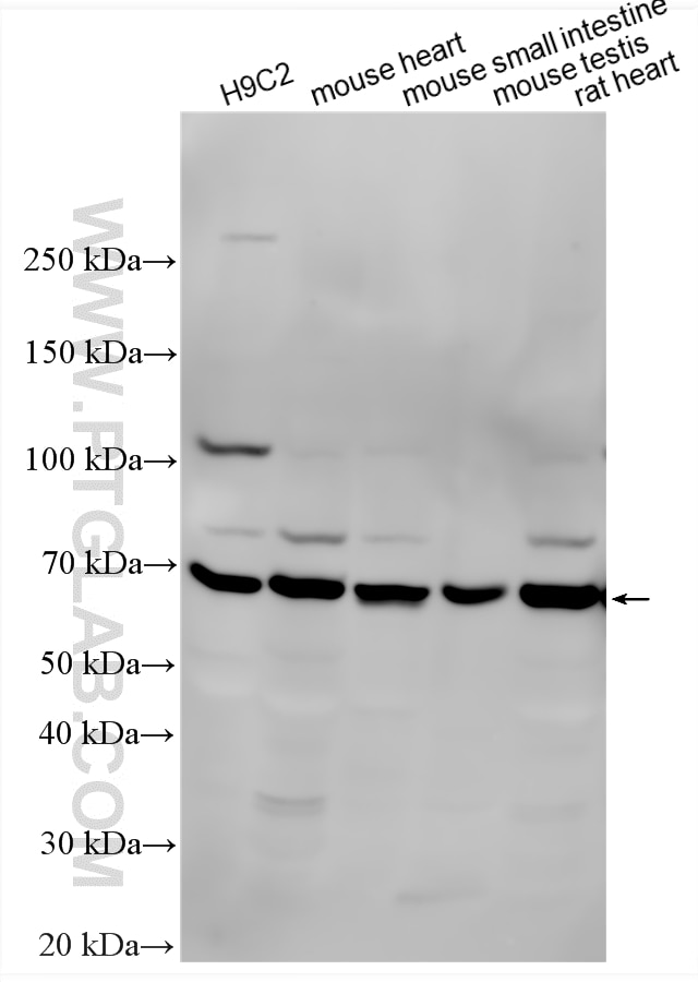 Various lysates were subjected to SDS PAGE followed by western blot with 12316-1-AP (ANGPTL2 antibody) at dilution of 1:2000 incubated at room temperature for 1.5 hours. Western Blot (WB) analysis of various lysates using ANGPTL2 Polyclonal antibody (12316-1-AP)