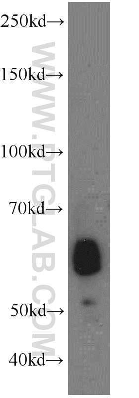 Western Blot (WB) analysis of mouse small intestine tissue using ANGPTL2 Polyclonal antibody (12316-1-AP)
