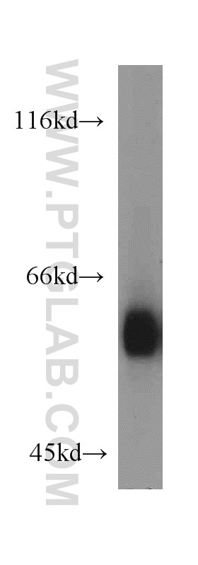 Western Blot (WB) analysis of mouse testis tissue using ANGPTL2 Polyclonal antibody (12316-1-AP)