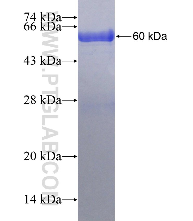 ANGPTL2 fusion protein Ag2969 SDS-PAGE