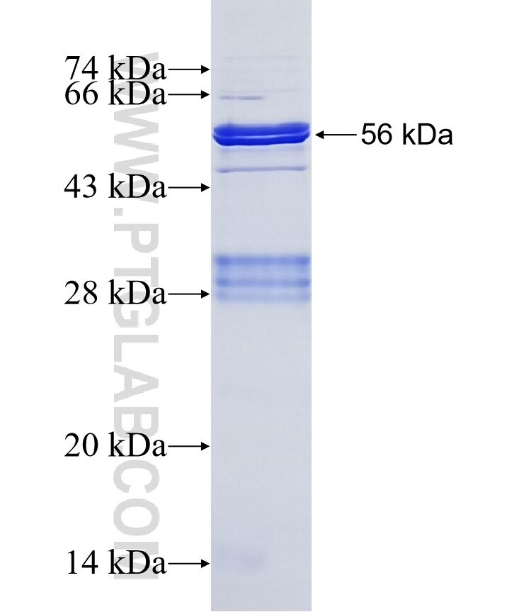 ANGPTL2 fusion protein Ag2969 SDS-PAGE