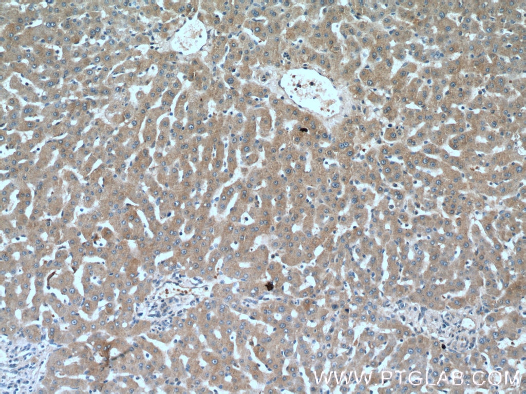 Immunohistochemistry (IHC) staining of human liver tissue using ANGPTL3 Polyclonal antibody (11964-1-AP)
