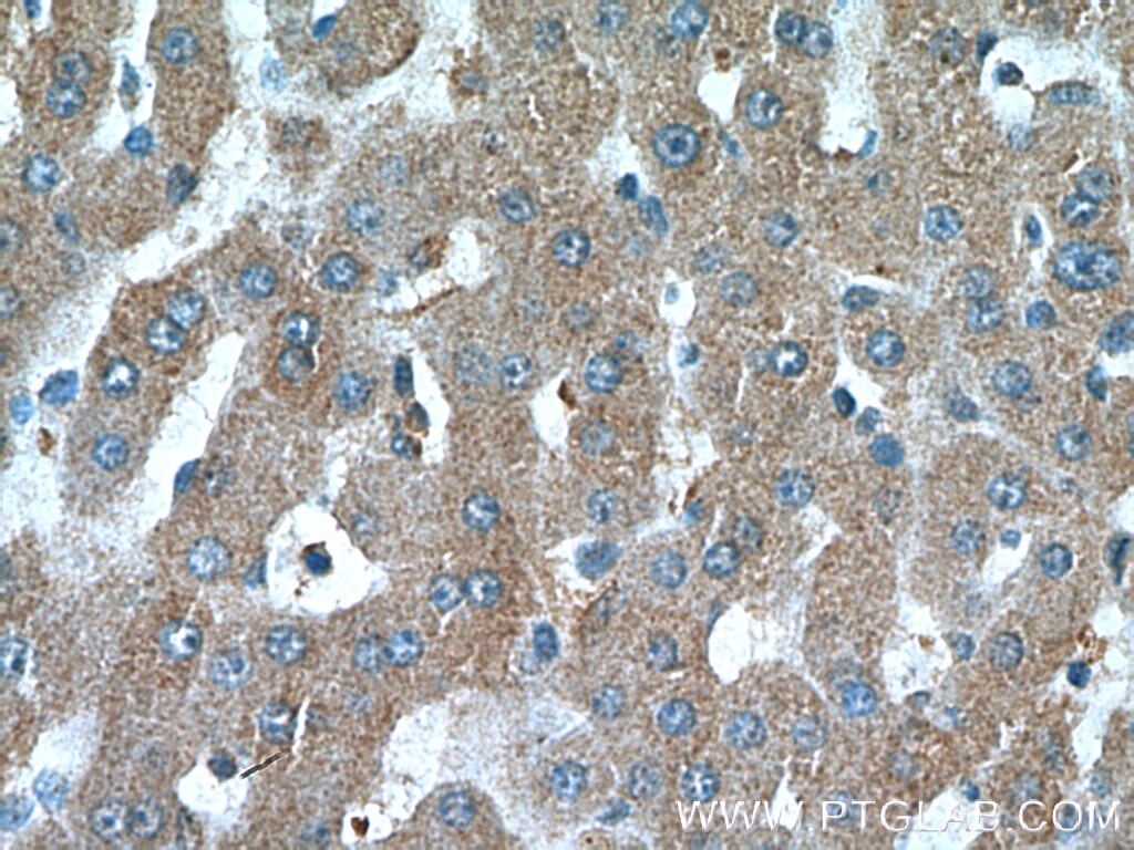 Immunohistochemistry (IHC) staining of human liver tissue using ANGPTL3 Polyclonal antibody (11964-1-AP)