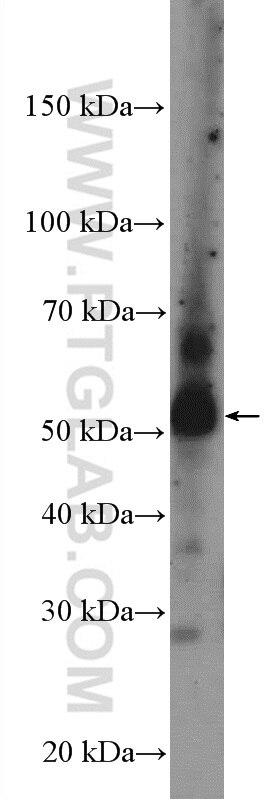 Western Blot (WB) analysis of mouse liver tissue using ANGPTL3 Polyclonal antibody (11964-1-AP)