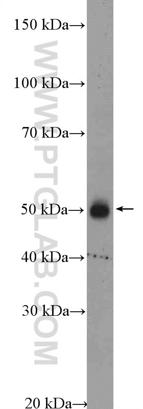 Western Blot (WB) analysis of A375 cells using ANGPTL3 Polyclonal antibody (11964-1-AP)