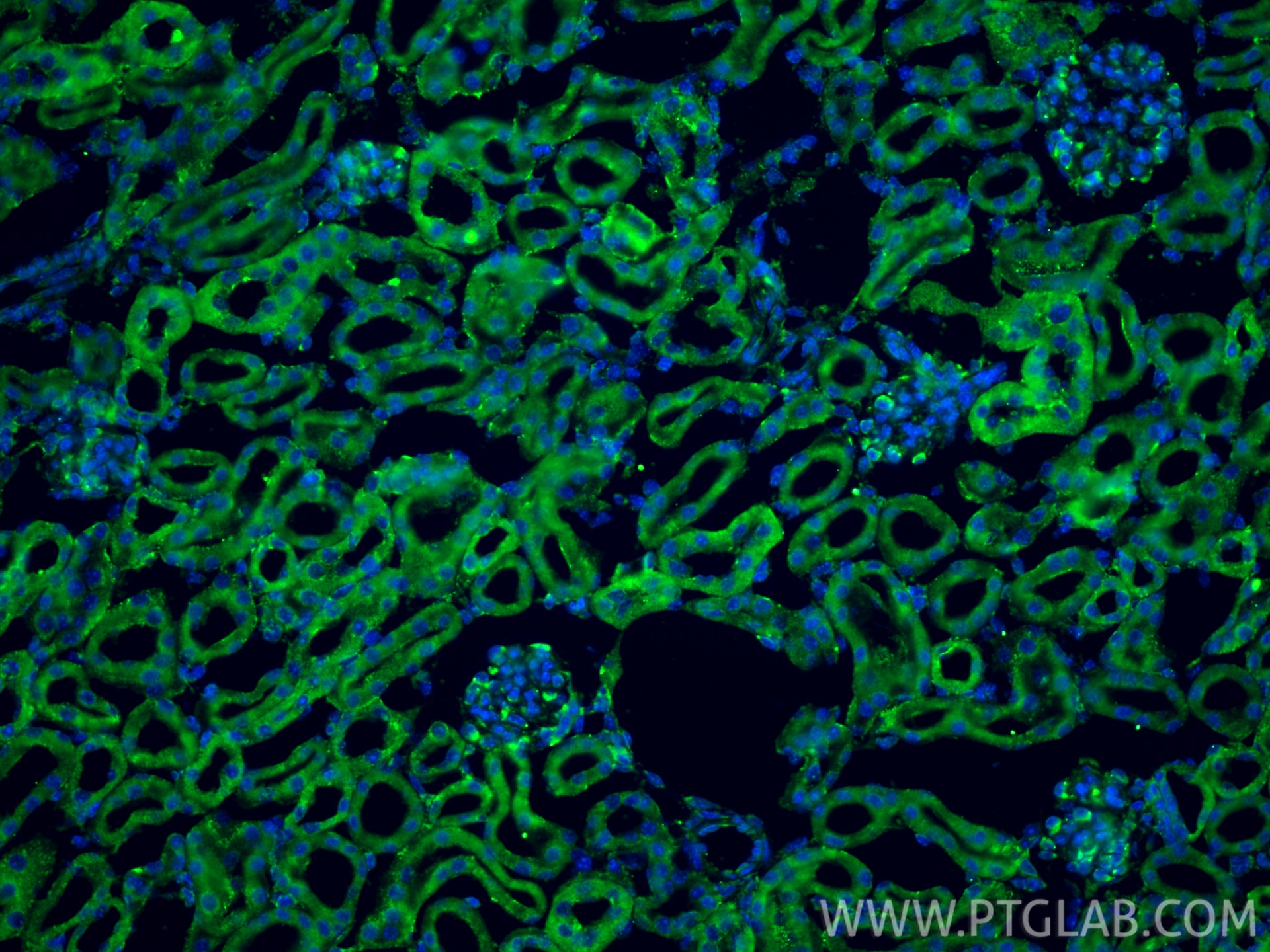 Immunofluorescence (IF) / fluorescent staining of mouse kidney tissue using ANGPTL3 Recombinant monoclonal antibody (86193-1-RR)
