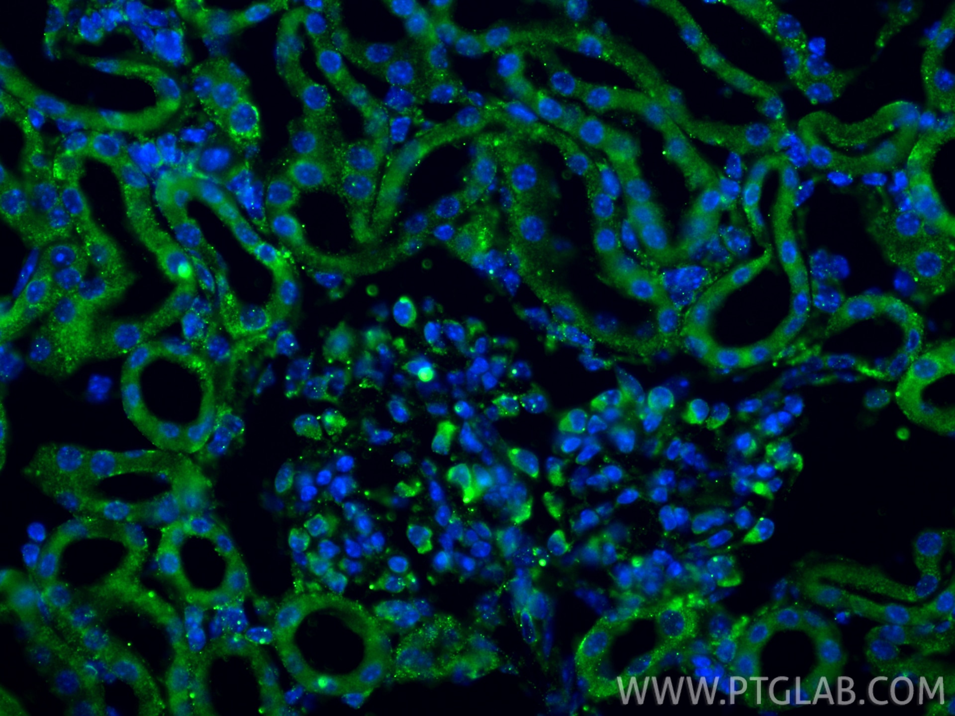 Immunofluorescence (IF) / fluorescent staining of mouse kidney tissue using ANGPTL3 Recombinant monoclonal antibody (86193-1-RR)
