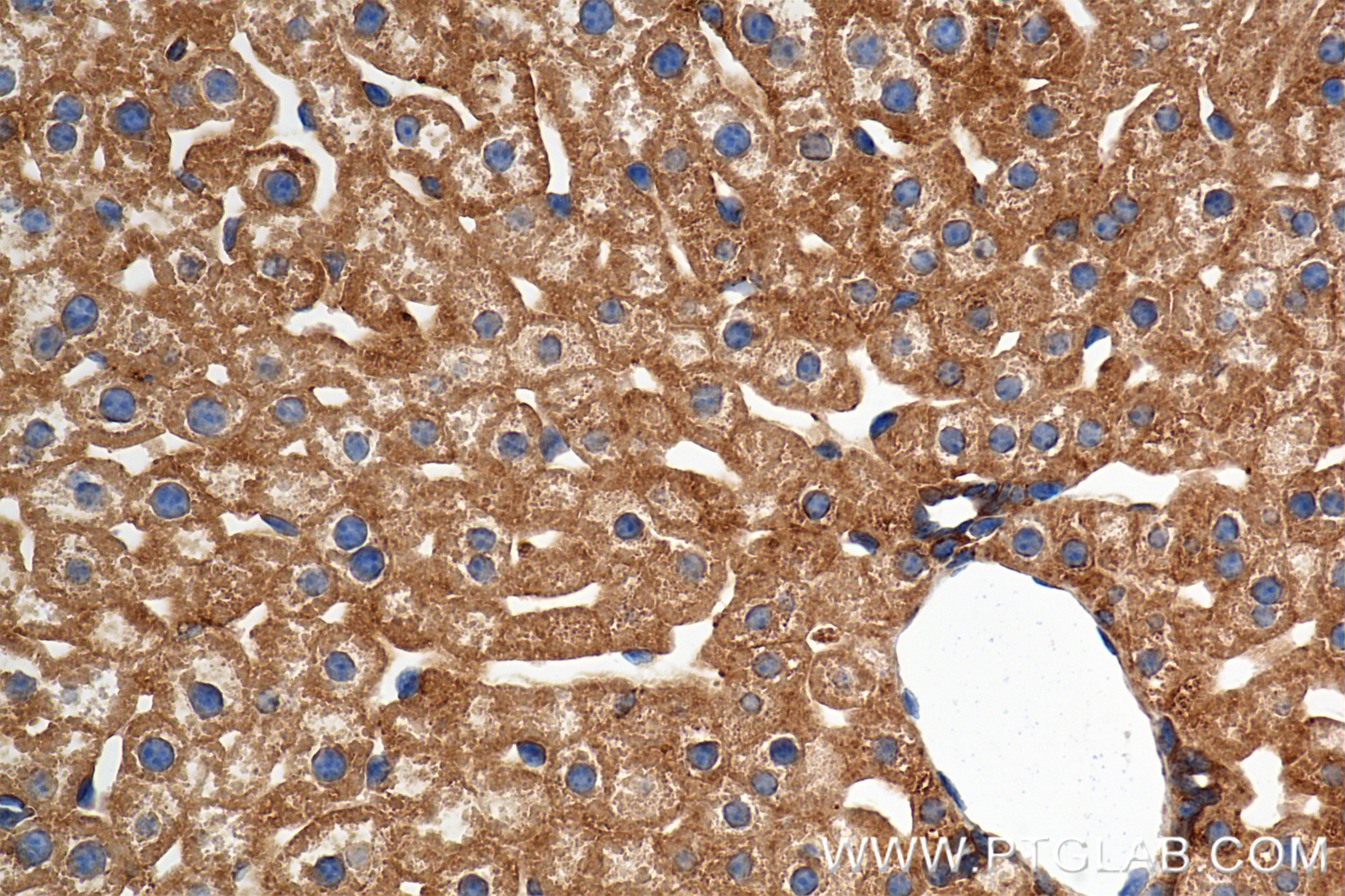 Immunohistochemistry (IHC) staining of mouse liver tissue using ANGPTL3 Recombinant antibody (86193-1-RR)