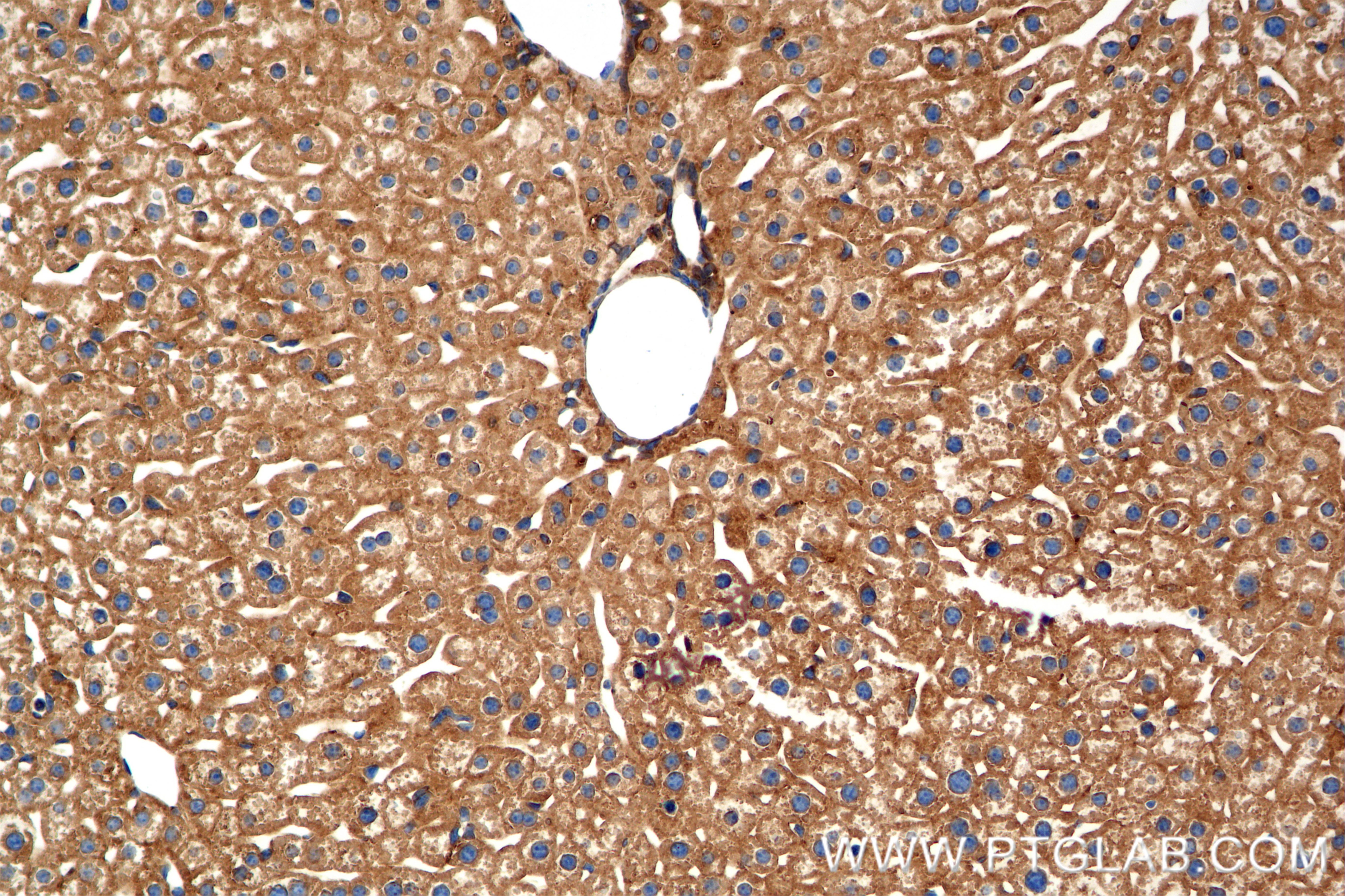Immunohistochemistry (IHC) staining of mouse liver tissue using ANGPTL3 Recombinant antibody (86193-1-RR)