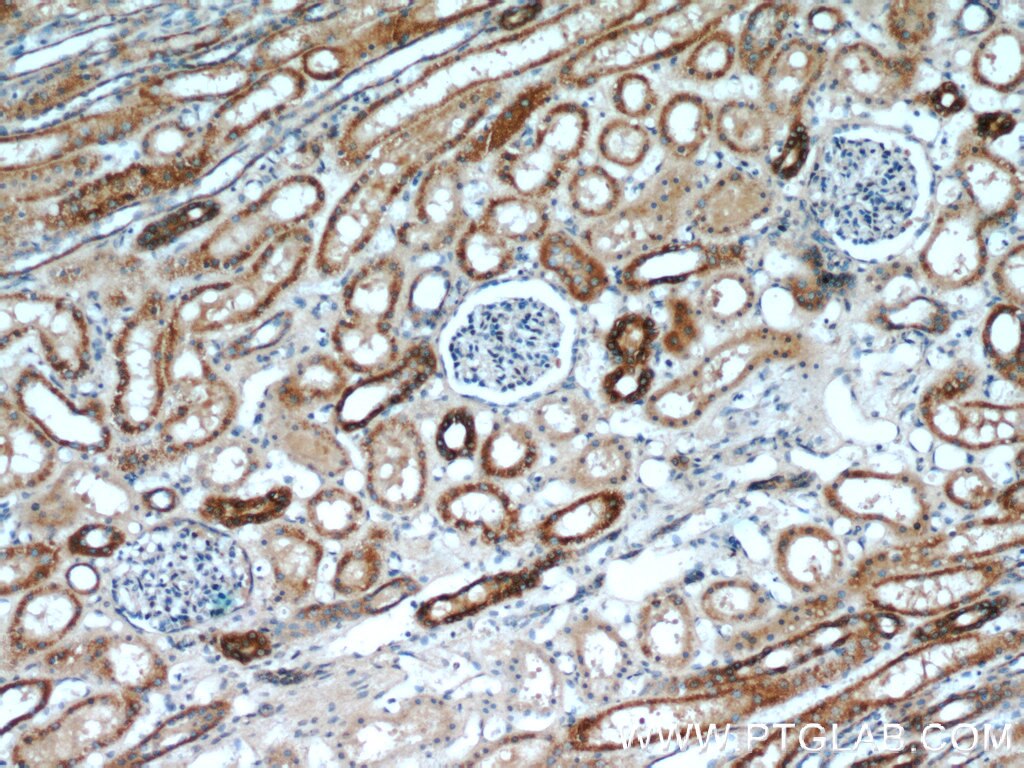Immunohistochemistry (IHC) staining of human kidney tissue using ANGPTL4 Polyclonal antibody (18374-1-AP)