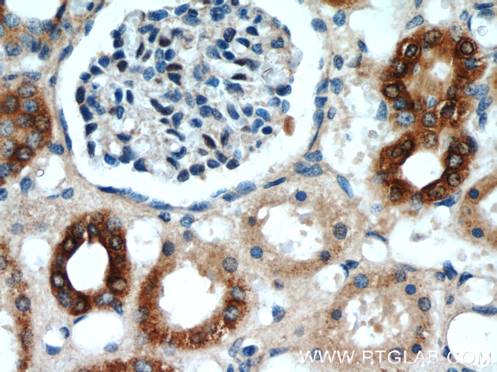 Immunohistochemistry (IHC) staining of human kidney tissue using ANGPTL4 Polyclonal antibody (18374-1-AP)