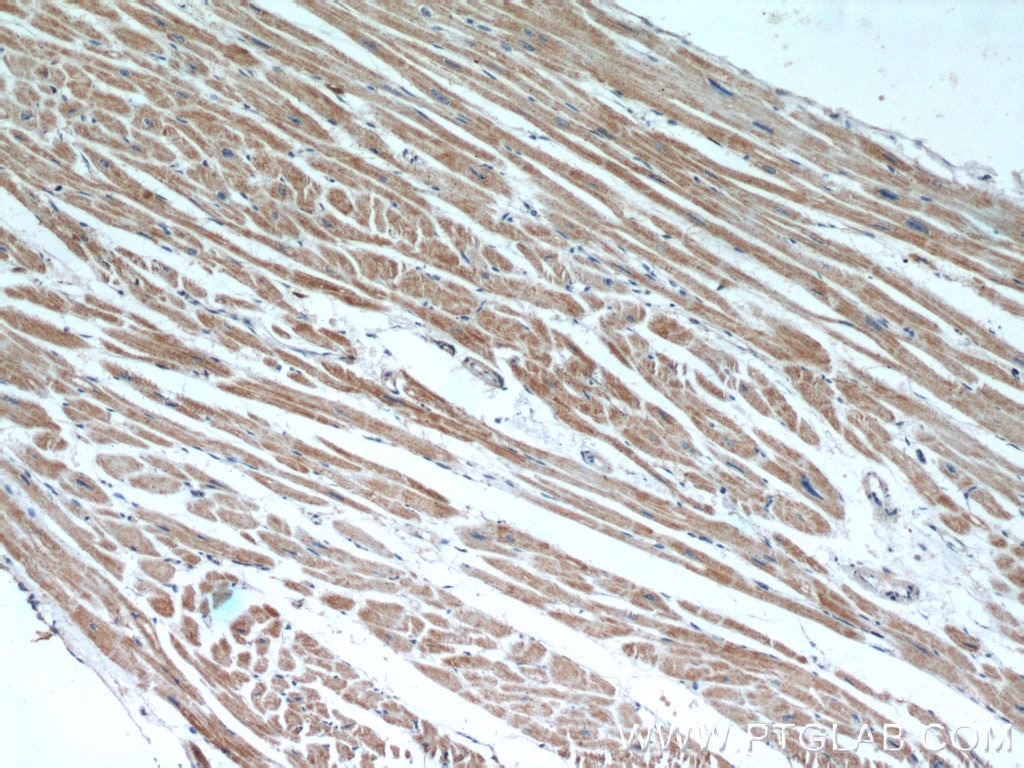 IHC staining of human heart using 18374-1-AP