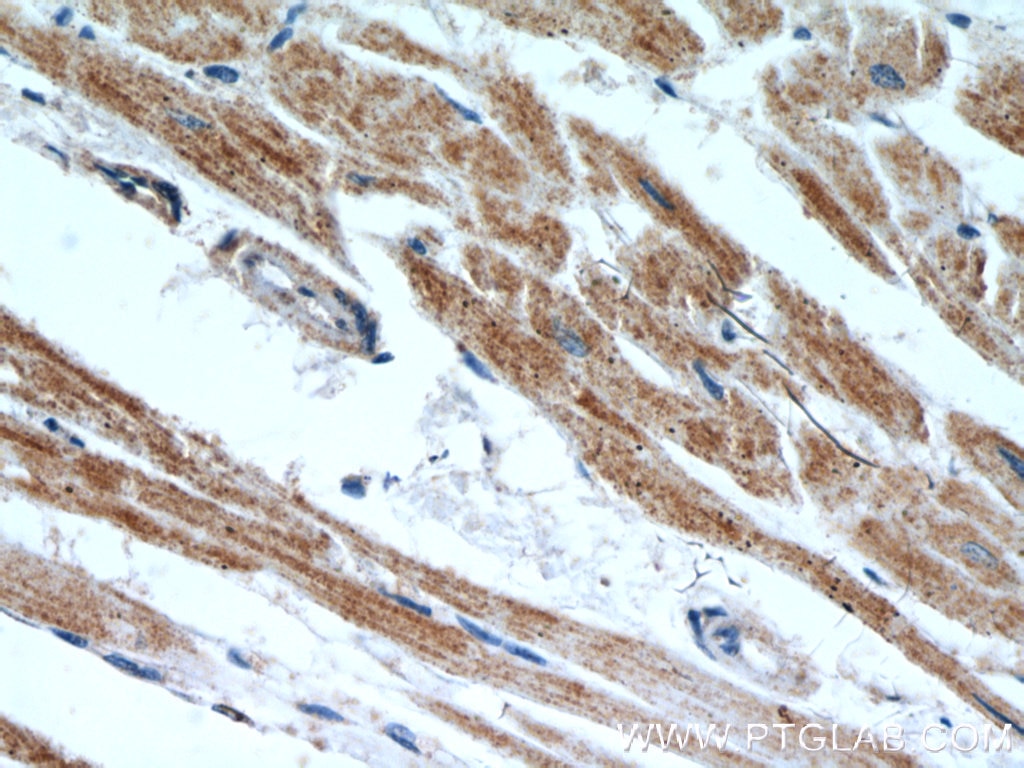 Immunohistochemistry (IHC) staining of human heart tissue using ANGPTL4 Polyclonal antibody (18374-1-AP)