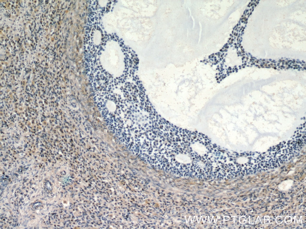 Immunohistochemistry (IHC) staining of human ovary tissue using ANGPTL4 Polyclonal antibody (18374-1-AP)