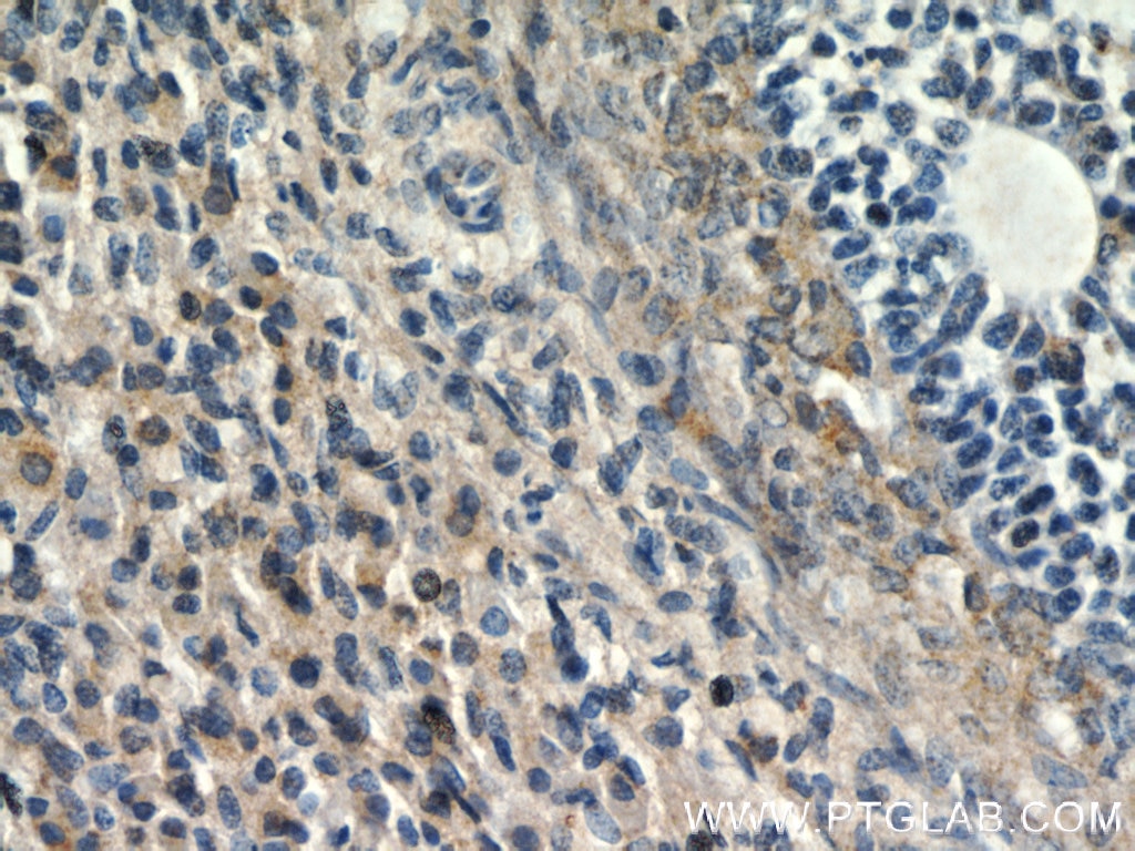 Immunohistochemistry (IHC) staining of human ovary tissue using ANGPTL4 Polyclonal antibody (18374-1-AP)