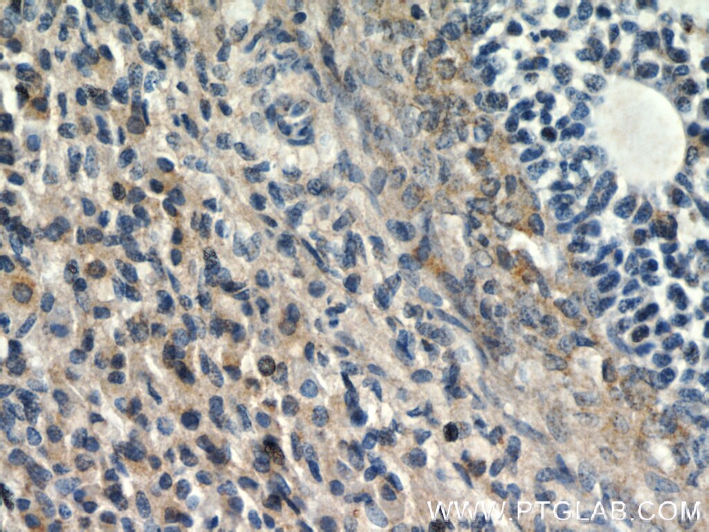 IHC staining of human ovary using 18374-1-AP